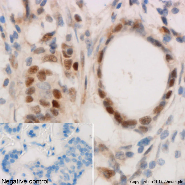 Immunohistochemistry (Formalin/PFA-fixed paraffin-embedded sections) - p53 Antibody Sampler Panel (AB219089)