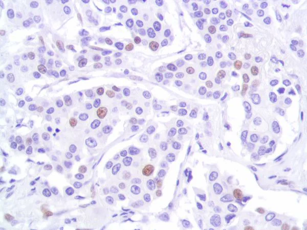 Immunohistochemistry (Formalin/PFA-fixed paraffin-embedded sections) - Anti-p53 antibody [SP161] (AB227655)