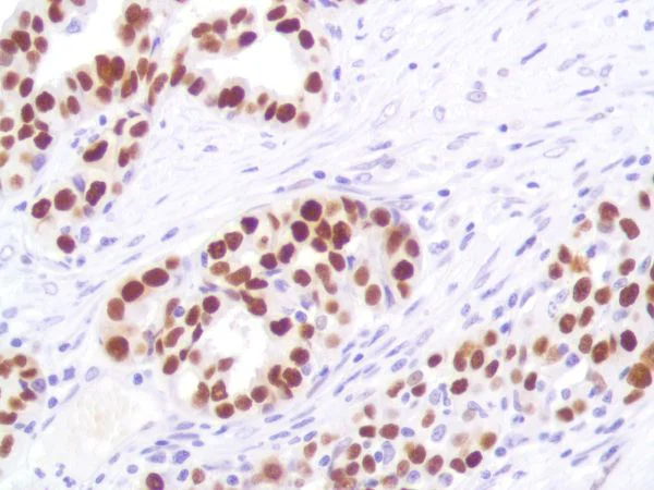 Immunohistochemistry (Formalin/PFA-fixed paraffin-embedded sections) - Anti-p53 antibody [SP161] (AB227655)