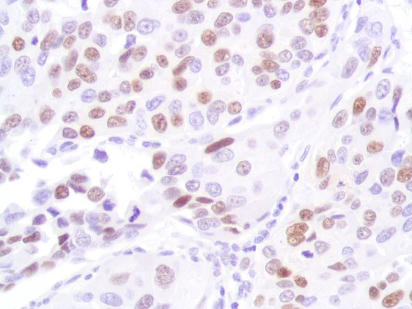 Immunohistochemistry (Formalin/PFA-fixed paraffin-embedded sections) - Anti-p53 antibody [SP161] (AB227655)