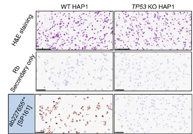 Immunohistochemistry (Formalin/PFA-fixed paraffin-embedded sections) - Anti-p53 antibody [SP161] (AB227655)