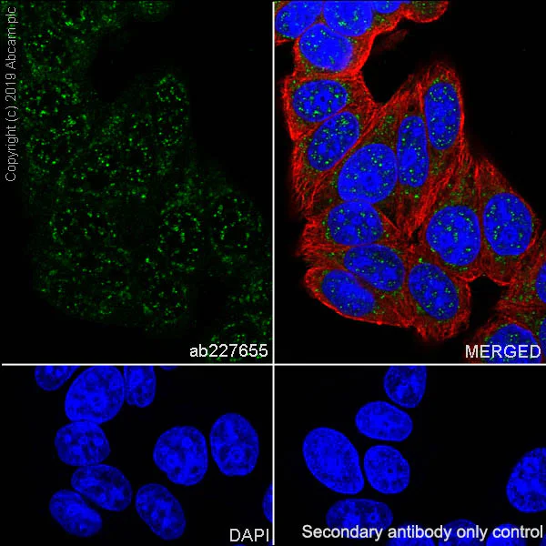 Immunocytochemistry/ Immunofluorescence - Anti-p53 antibody [SP161] - BSA and Azide free (AB245740)