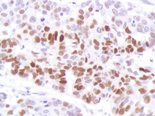 Immunohistochemistry (Formalin/PFA-fixed paraffin-embedded sections) - Anti-p53 antibody [SP161] - BSA and Azide free (AB245740)