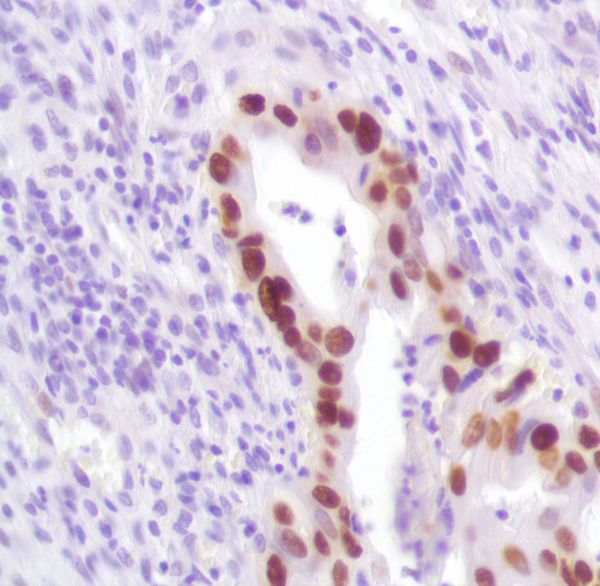 Immunohistochemistry (Formalin/PFA-fixed paraffin-embedded sections) - Anti-p53 antibody [SP161] - BSA and Azide free (AB245740), expandable thumbnail