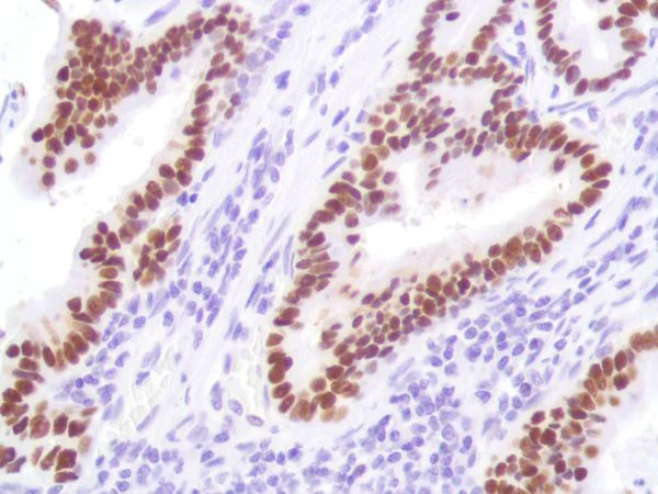 Immunohistochemistry (Formalin/PFA-fixed paraffin-embedded sections) - Anti-p53 antibody [SP161] - BSA and Azide free (AB245740)