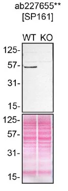 Western blot - Anti-p53 antibody [SP161] - BSA and Azide free (AB245740)