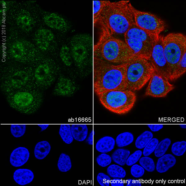 Immunocytochemistry/ Immunofluorescence - Anti-p53 antibody [SP5] (AB16665), expandable thumbnail