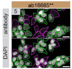 Immunocytochemistry/ Immunofluorescence - Anti-p53 antibody [SP5] (AB16665)