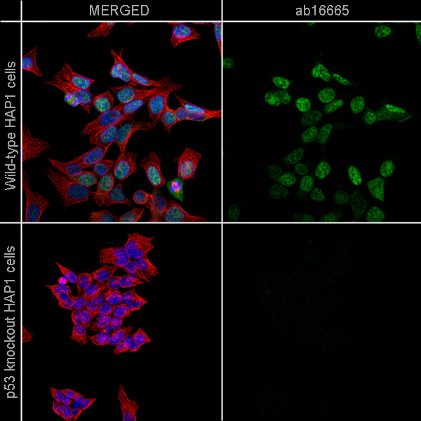 Immunocytochemistry/ Immunofluorescence - Anti-p53 antibody [SP5] (AB16665), expandable thumbnail