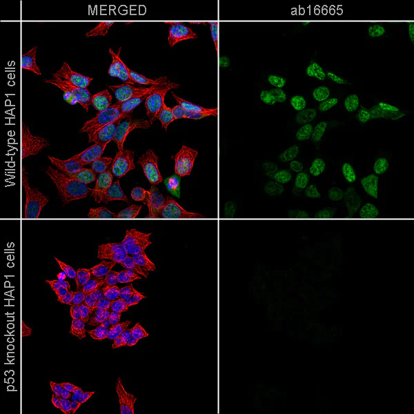 Immunocytochemistry/ Immunofluorescence - Anti-p53 antibody [SP5] (AB16665)