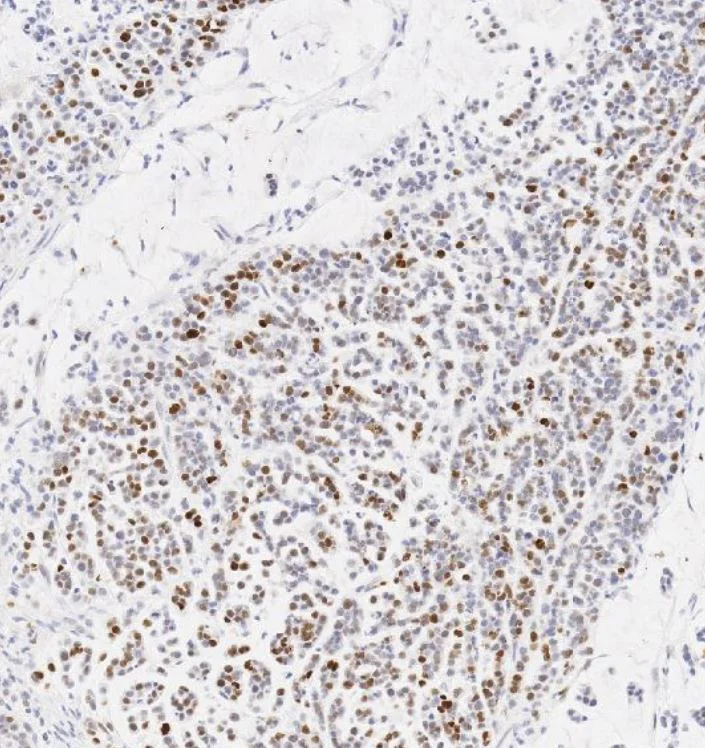 Immunohistochemistry (Formalin/PFA-fixed paraffin-embedded sections) - Anti-p53 antibody [SP5] (AB16665)