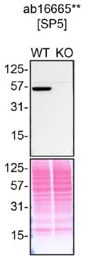 Western blot - Anti-p53 antibody [SP5] (AB16665)