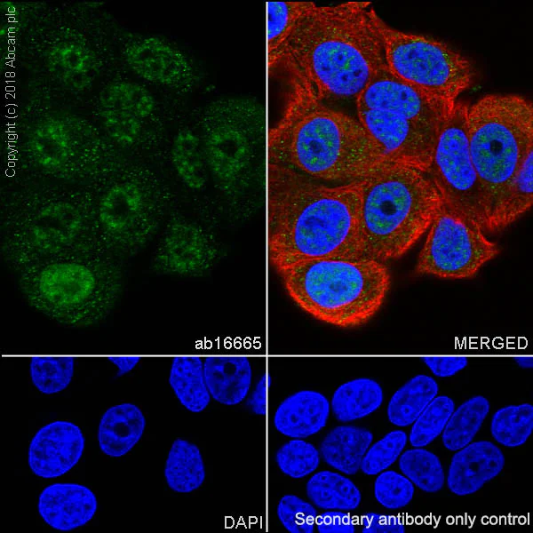 Immunocytochemistry/ Immunofluorescence - Anti-p53 antibody [SP5] - BSA and Azide free (AB242379)