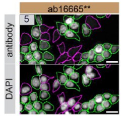 Immunocytochemistry/ Immunofluorescence - Anti-p53 antibody [SP5] - BSA and Azide free (AB242379)