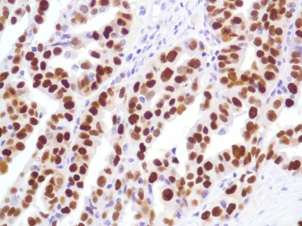 Immunohistochemistry (Formalin/PFA-fixed paraffin-embedded sections) - Anti-p53 antibody [SP5] - BSA and Azide free (AB242379)