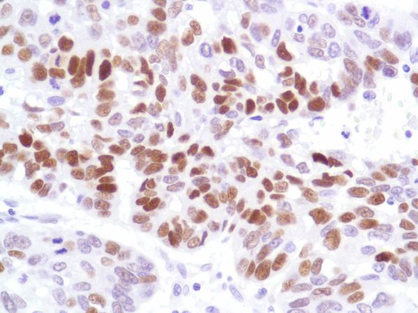 Immunohistochemistry (Formalin/PFA-fixed paraffin-embedded sections) - Anti-p53 antibody [SP5] - BSA and Azide free (AB242379), expandable thumbnail
