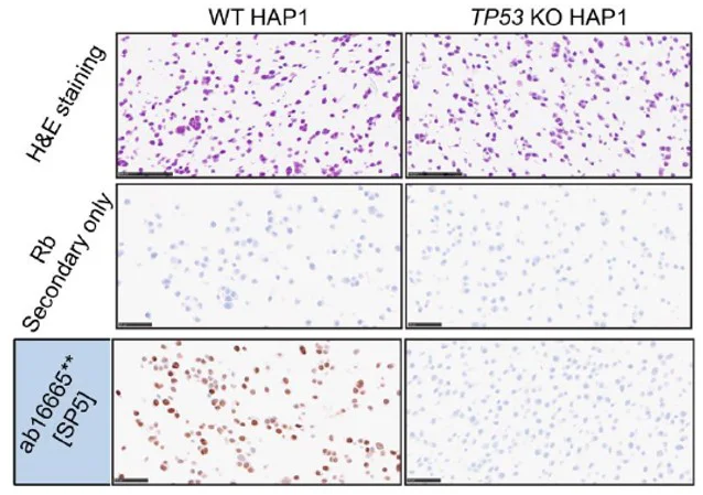 Immunohistochemistry (Formalin/PFA-fixed paraffin-embedded sections) - Anti-p53 antibody [SP5] - BSA and Azide free (AB242379)