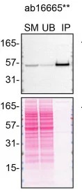 Immunoprecipitation - Anti-p53 antibody [SP5] - BSA and Azide free (AB242379)