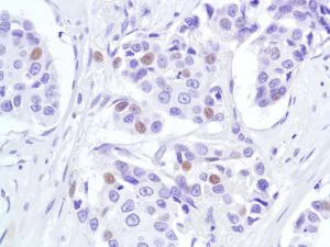 Immunohistochemistry (Formalin/PFA-fixed paraffin-embedded sections) - Anti-p53 antibody [SP5], prediluted (AB27598)