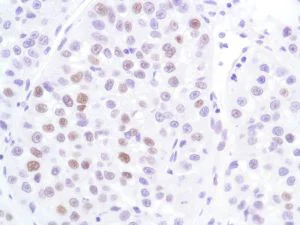 Immunohistochemistry (Formalin/PFA-fixed paraffin-embedded sections) - Anti-p53 antibody [SP5], prediluted (AB27598)