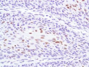 Immunohistochemistry (Formalin/PFA-fixed paraffin-embedded sections) - Anti-p53 antibody [SP5], prediluted (AB27598)