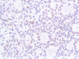 Immunohistochemistry (Formalin/PFA-fixed paraffin-embedded sections) - Anti-p53 antibody [SP5], prediluted (AB27598)