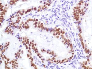 Immunohistochemistry (Formalin/PFA-fixed paraffin-embedded sections) - Anti-p53 antibody [SP5], prediluted (AB27598)