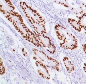 Immunohistochemistry (Formalin/PFA-fixed paraffin-embedded sections) - Anti-p53 antibody [SP5], prediluted (AB27598)
