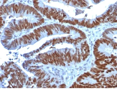 Immunohistochemistry (Formalin/PFA-fixed paraffin-embedded sections) - Anti-p53 antibody [TP53/1739] (AB238069)