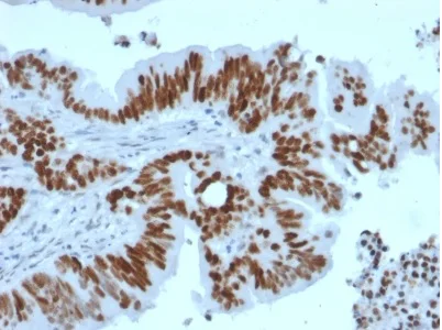 Immunohistochemistry (Formalin/PFA-fixed paraffin-embedded sections) - Anti-p53 antibody [TP53/2092R] (AB238071)