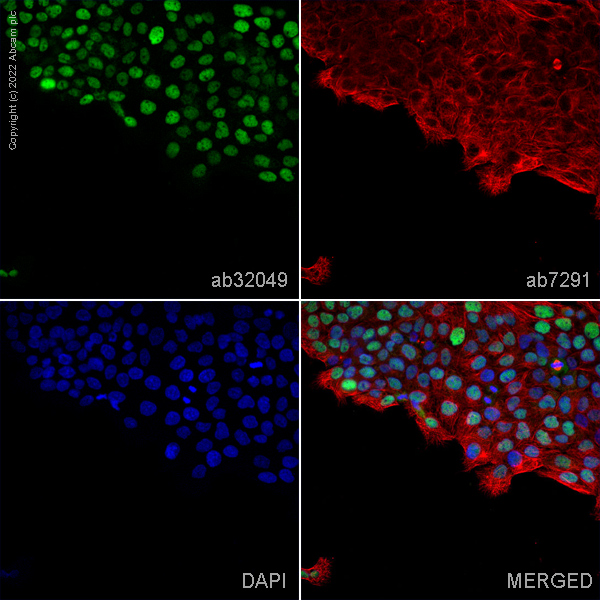 Immunocytochemistry/ Immunofluorescence - Anti-p53 antibody [Y5] (ab32049), expandable thumbnail