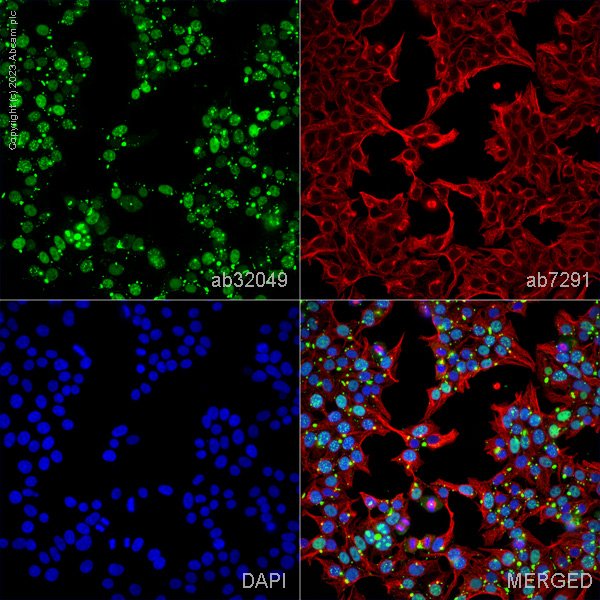 Immunocytochemistry/ Immunofluorescence - Anti-p53 antibody [Y5] (ab32049), expandable thumbnail