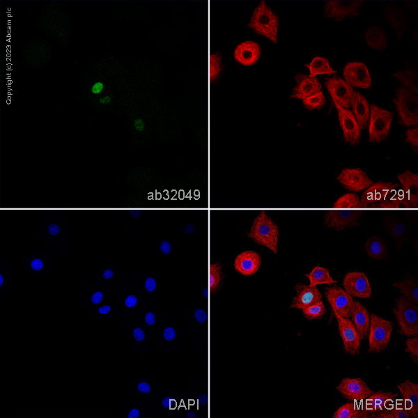 Immunocytochemistry/ Immunofluorescence - Anti-p53 antibody [Y5] (ab32049), expandable thumbnail