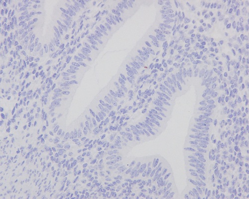 Immunohistochemistry (Formalin/PFA-fixed paraffin-embedded sections) - Anti-p53 antibody [Y5] (AB32049), expandable thumbnail