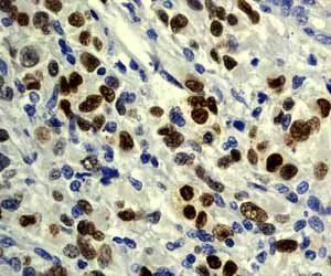 Immunohistochemistry (Formalin/PFA-fixed paraffin-embedded sections) - Anti-p53 antibody [Y5] (AB32049)