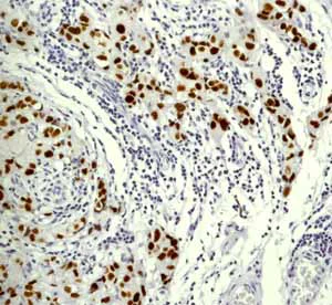 Immunohistochemistry (Formalin/PFA-fixed paraffin-embedded sections) - Anti-p53 antibody [Y5] (AB32049)