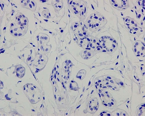 Immunohistochemistry (Formalin/PFA-fixed paraffin-embedded sections) - Anti-p53 antibody [Y5] (ab32049), expandable thumbnail