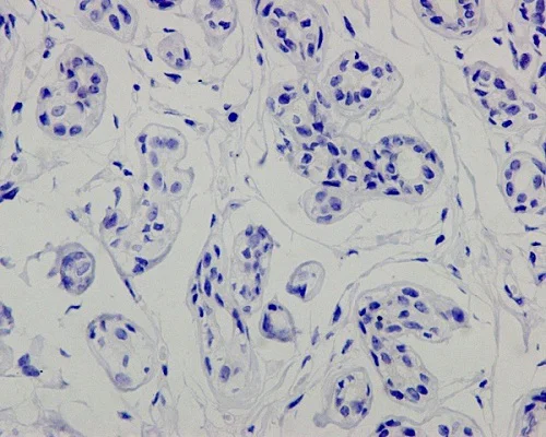 Immunohistochemistry (Formalin/PFA-fixed paraffin-embedded sections) - Anti-p53 antibody [Y5] (AB32049)