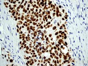 Immunohistochemistry (Formalin/PFA-fixed paraffin-embedded sections) - Anti-p53 antibody [Y5] (ab32049), expandable thumbnail