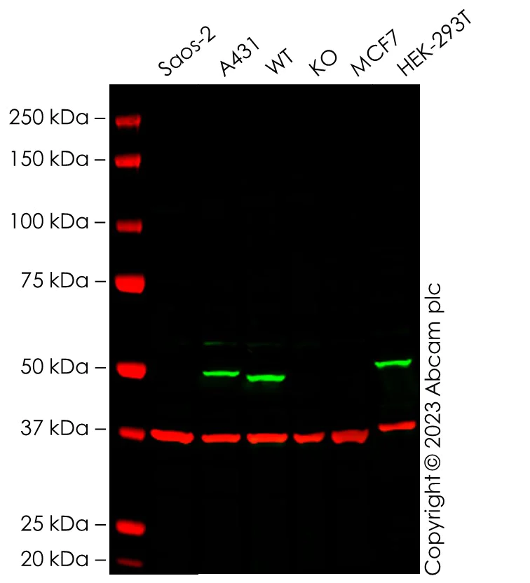 Western blot - Anti-p53 antibody [Y5] (AB32049)