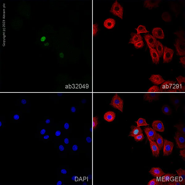 Immunocytochemistry/ Immunofluorescence - Anti-p53 antibody [Y5] - BSA and Azide free (AB219731)