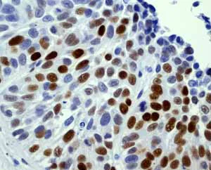 Immunohistochemistry (Formalin/PFA-fixed paraffin-embedded sections) - Anti-p53 antibody [Y5] - BSA and Azide free (AB219731)