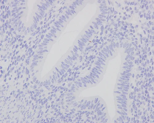 Immunohistochemistry (Formalin/PFA-fixed paraffin-embedded sections) - Anti-p53 antibody [Y5] - BSA and Azide free (AB219731)