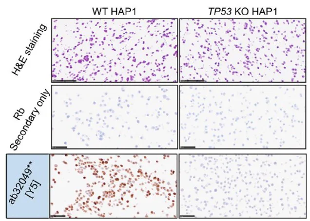 Immunohistochemistry (Formalin/PFA-fixed paraffin-embedded sections) - Anti-p53 antibody [Y5] - BSA and Azide free (AB219731)