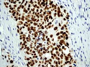 Immunohistochemistry (Formalin/PFA-fixed paraffin-embedded sections) - Anti-p53 antibody [Y5] - BSA and Azide free (AB219731)