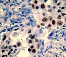 Immunohistochemistry (Formalin/PFA-fixed paraffin-embedded sections) - Anti-p53 antibody [Y5] - BSA and Azide free (AB219731)