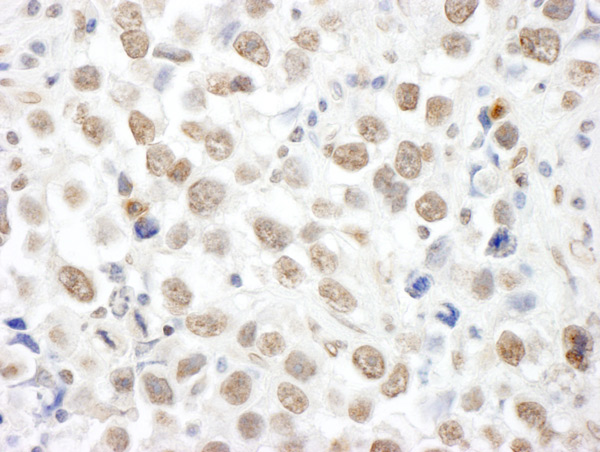 Immunohistochemistry (Formalin/PFA-fixed paraffin-embedded sections) - Anti-p53 BP3 antibody (AB86383), expandable thumbnail