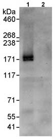 Immunoprecipitation - Anti-p53 BP3 antibody (AB86383), expandable thumbnail