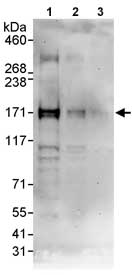 Western blot - Anti-p53 BP3 antibody (AB86383), expandable thumbnail