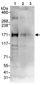 Western blot - Anti-p53 BP3 antibody (AB86383)